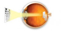 Vidění s astigmatismem